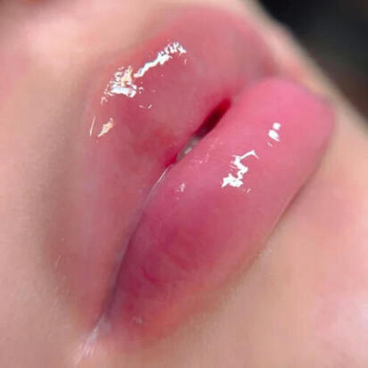 Hydra Lips