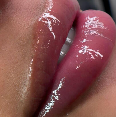 Hydra Lips
